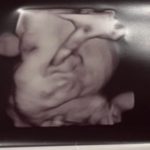 Thumbnail of related posts 041